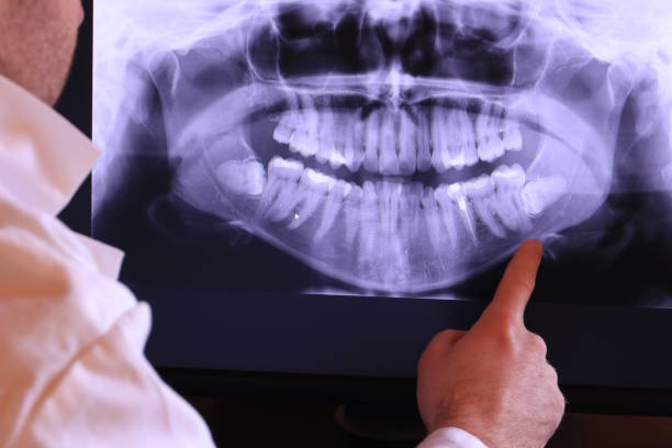 Best Urgent Dental Care for Toothache in Governors Village, NC