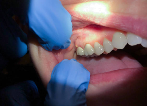 Best Orthodontic Emergency Dentist in Governors Village, NC