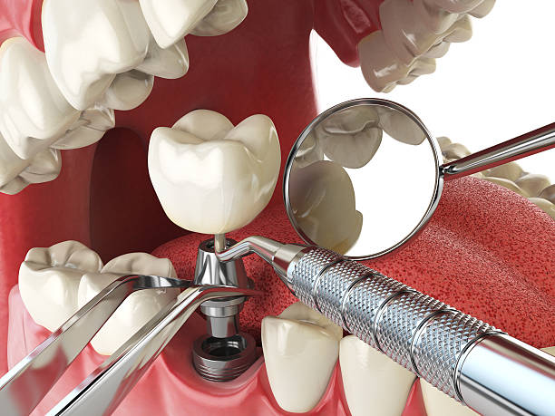 Best Pediatric Emergency Dentist in Governors Village, NC